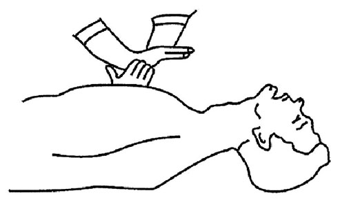 Взаимное расположение ладоней левой и правой руки выполняющего непрямой массаж сердца