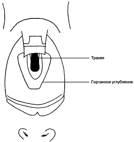 Вид гортани при проведении ларингоскопии прямым клинком