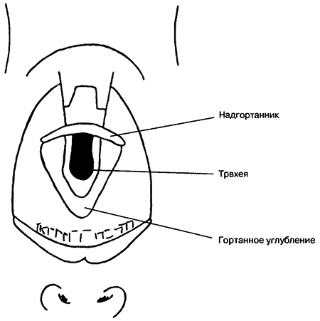 Вид гортани при проведении ларингоскопии изогнутым клинком