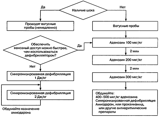 Алгоритм лечения наджелудочковой тахикардии