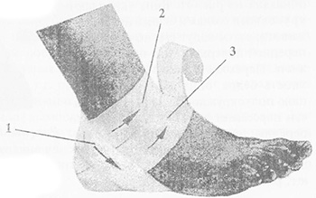 Повязка на область пятки