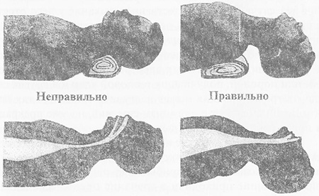 Расположение валика под плечевым поясом