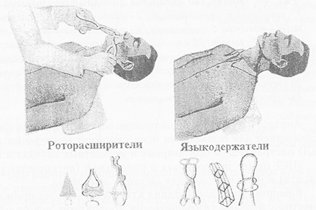 Извлечение и закрепление запавшего языка